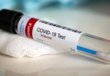 Coronavirus, 26.719 i positivi in Emilia Romagna, 121 in più di ieri