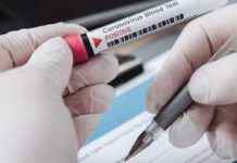 Coronavirus, 17 nuovi positivi in Emilia Romagna